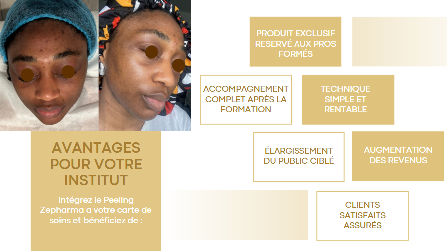 👩🏾🎓👨🏻🎓Formation en Peeling éclair ZEPHARMA – Maîtrisez une Technique Naturelle et Efficace ! 🌿✨