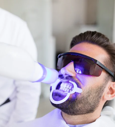 Blanchiment Dentaire Zepharma ⚜ – Sourire éclatant et naturel